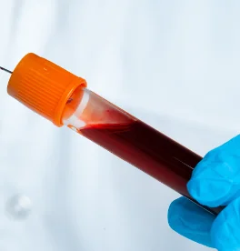 Blood Collection Tube