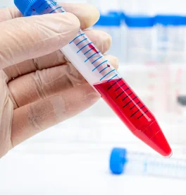 Centrifuge Tubes